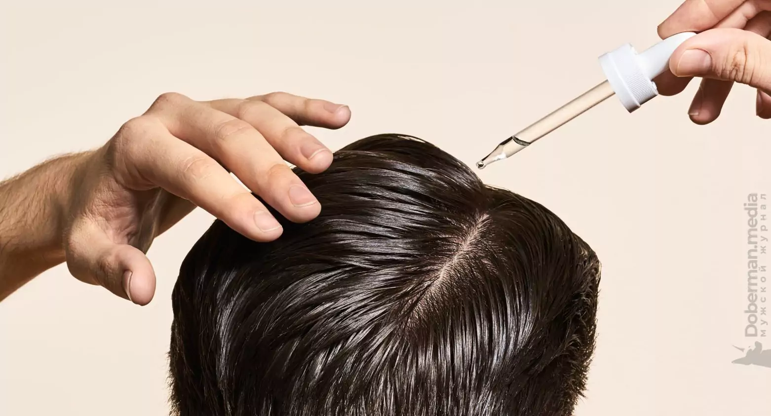 Minoxidil: The Secret to Preventing Hair Loss 2 786857463 5 2 2 2 7 3 2 4 3 66 677276c00737a