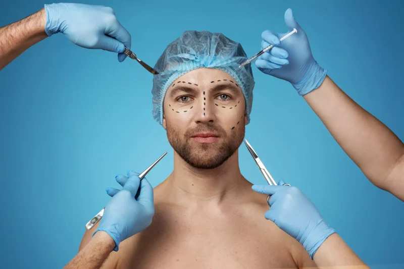 A new trend in Silicon Valley: male IT professionals are flocking to get Botox and plastic surgery